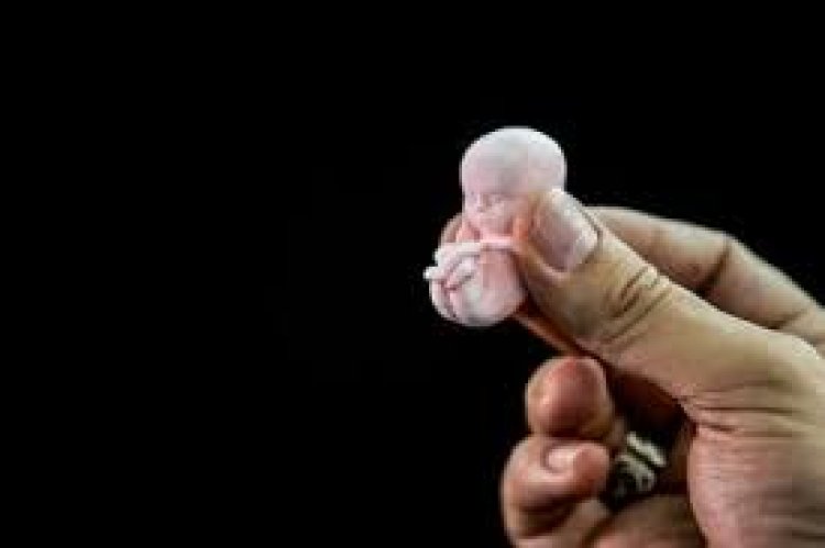 Aborto defendido pelo governo Lula não tem aprovação do povo brasileiro.